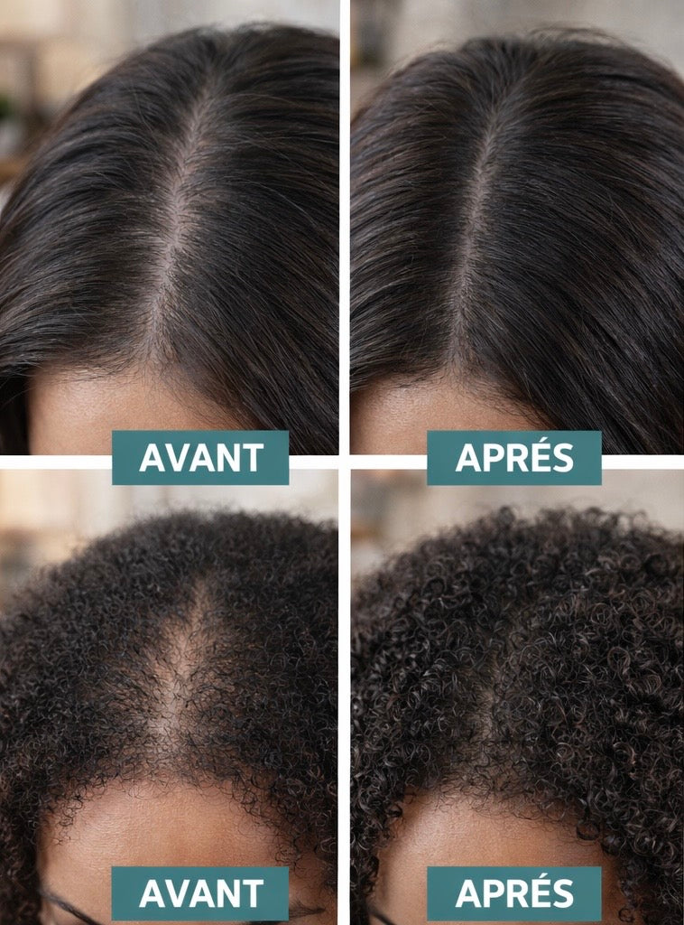 Peigne de Massage Lumineux NALAYA – Stimule la Pousse des Cheveux